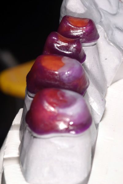 Modellation Modellation